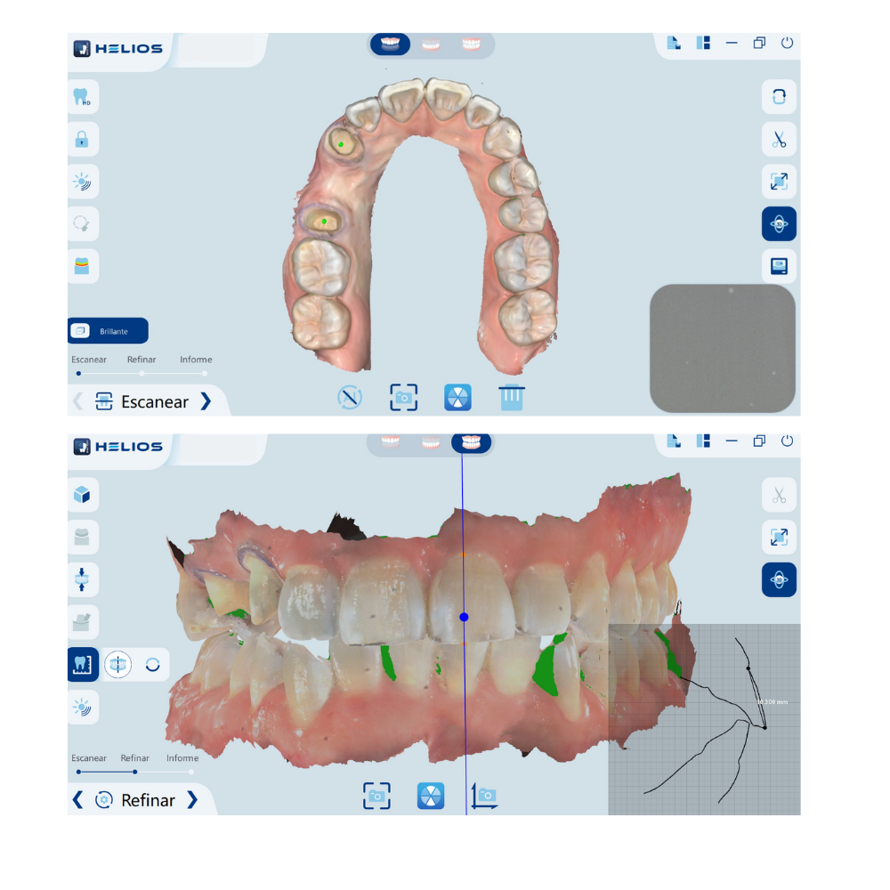 Escáner Intraoral Helios 500 – Eighteeth
