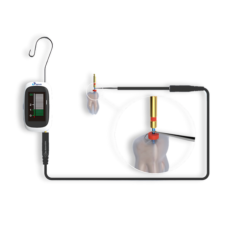 AirPex – Localizador de Ápice Inalámbrico