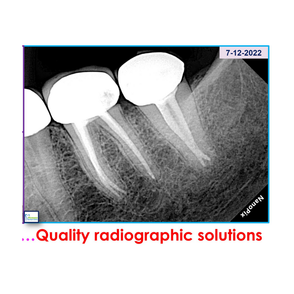 Unidad de rayos X portátil