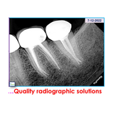 Unidad de rayos X portátil